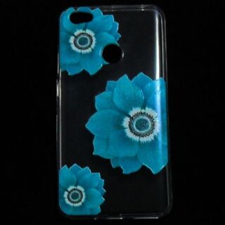 Capa Xiaomi Redmi Note 5A Gel Fashion - Flor Azul